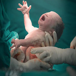 زایمان طبیعی بدون درد چگونه است؟